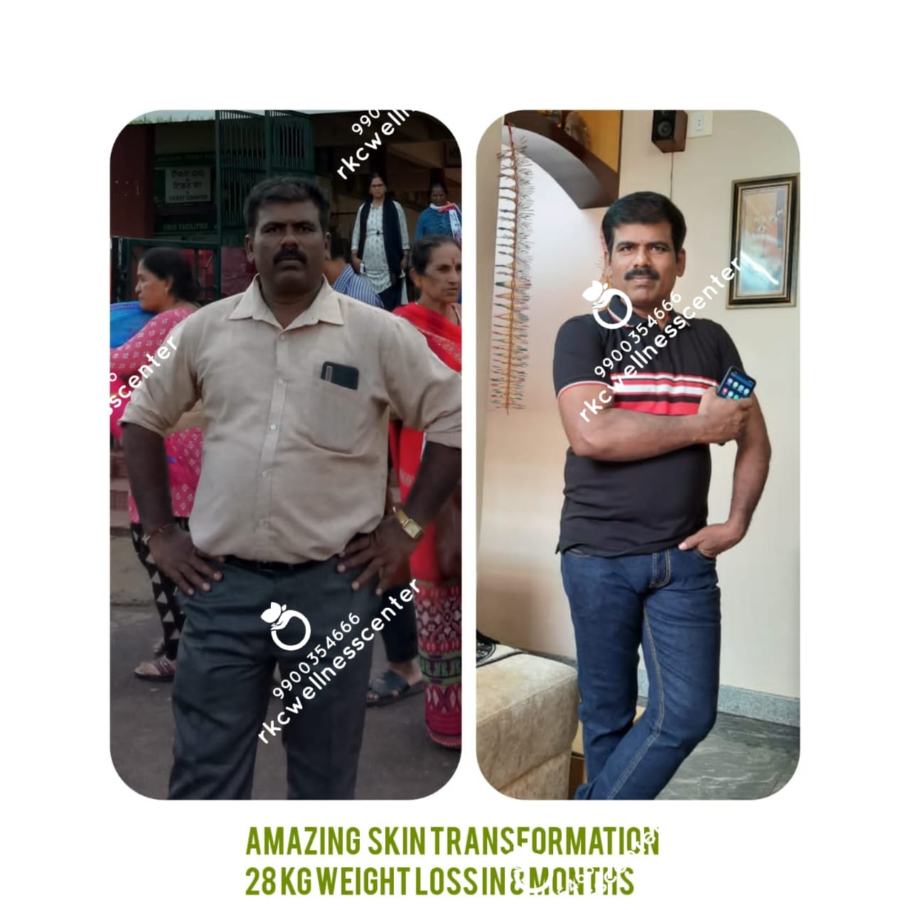 RKC Weight Loss Wellness Center - Album - Kumar