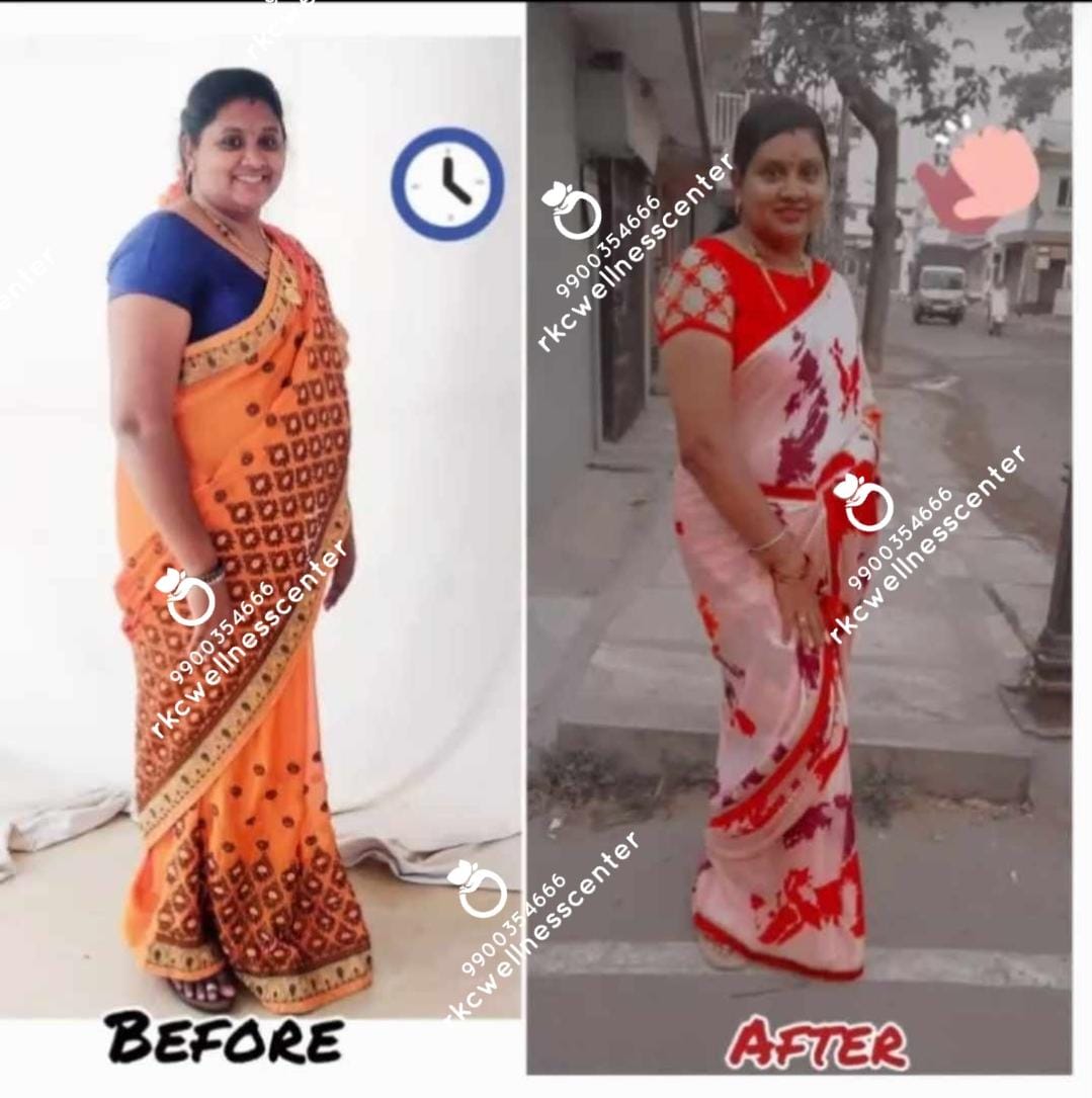 RKC Weight Loss Wellness Center - Album - Healthy 10 kg weight loss of simple house wife at the comfort of home