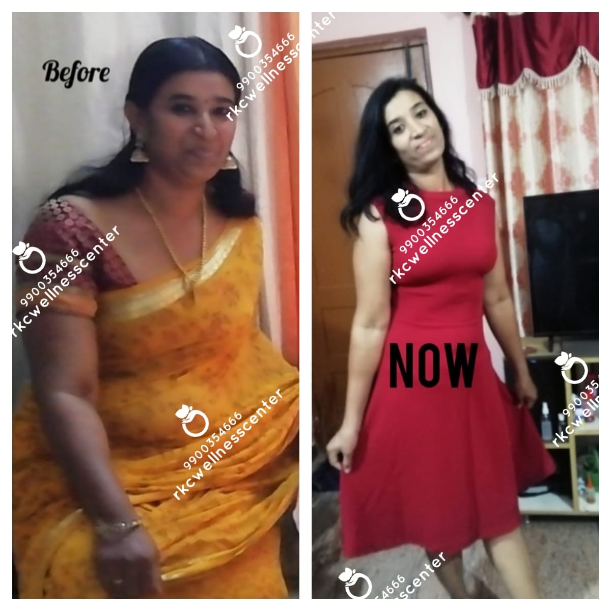 RKC Weight Loss Wellness Center - Latest update - Weight Loss Center Near RT Nagar